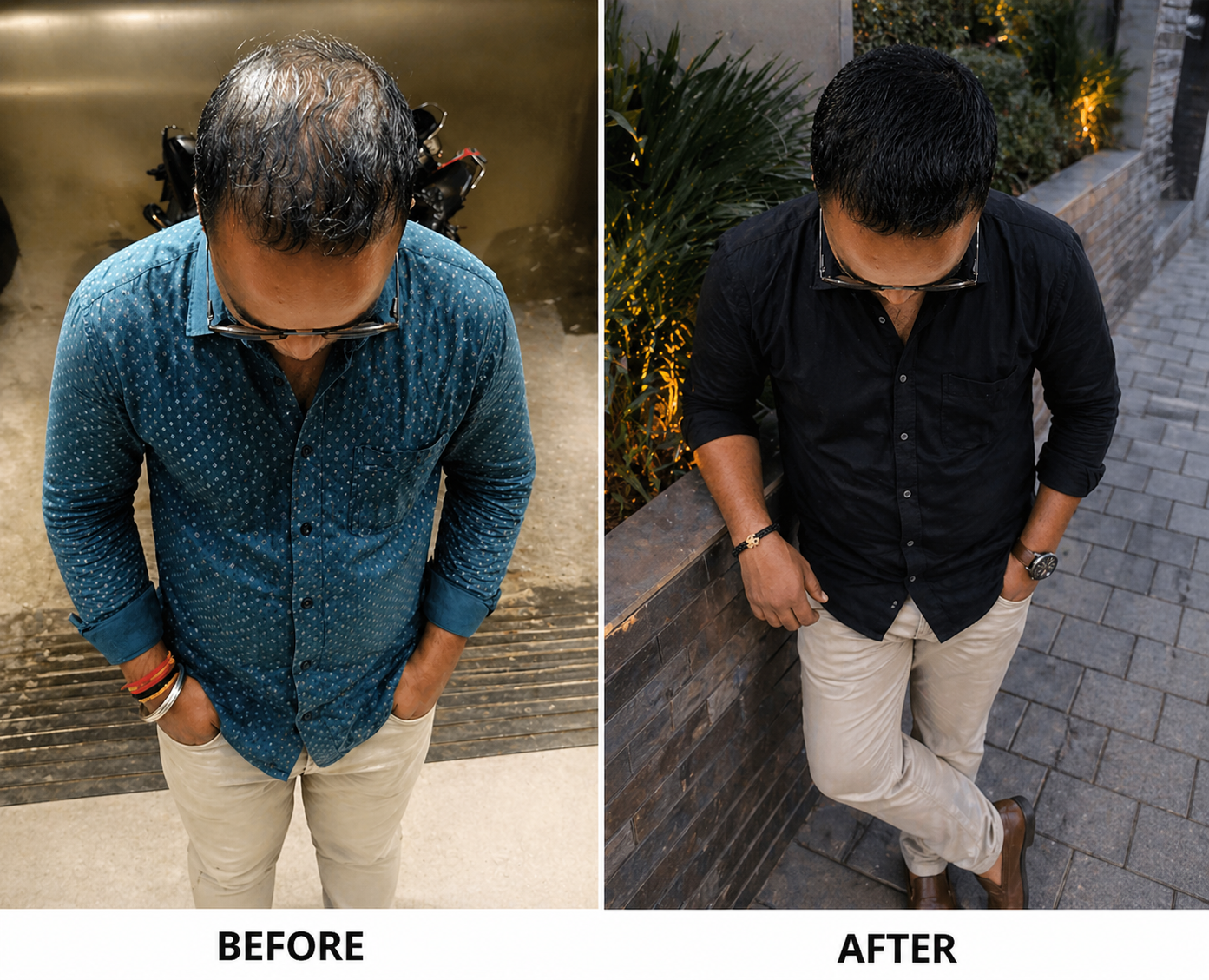 Hairfall reasons 